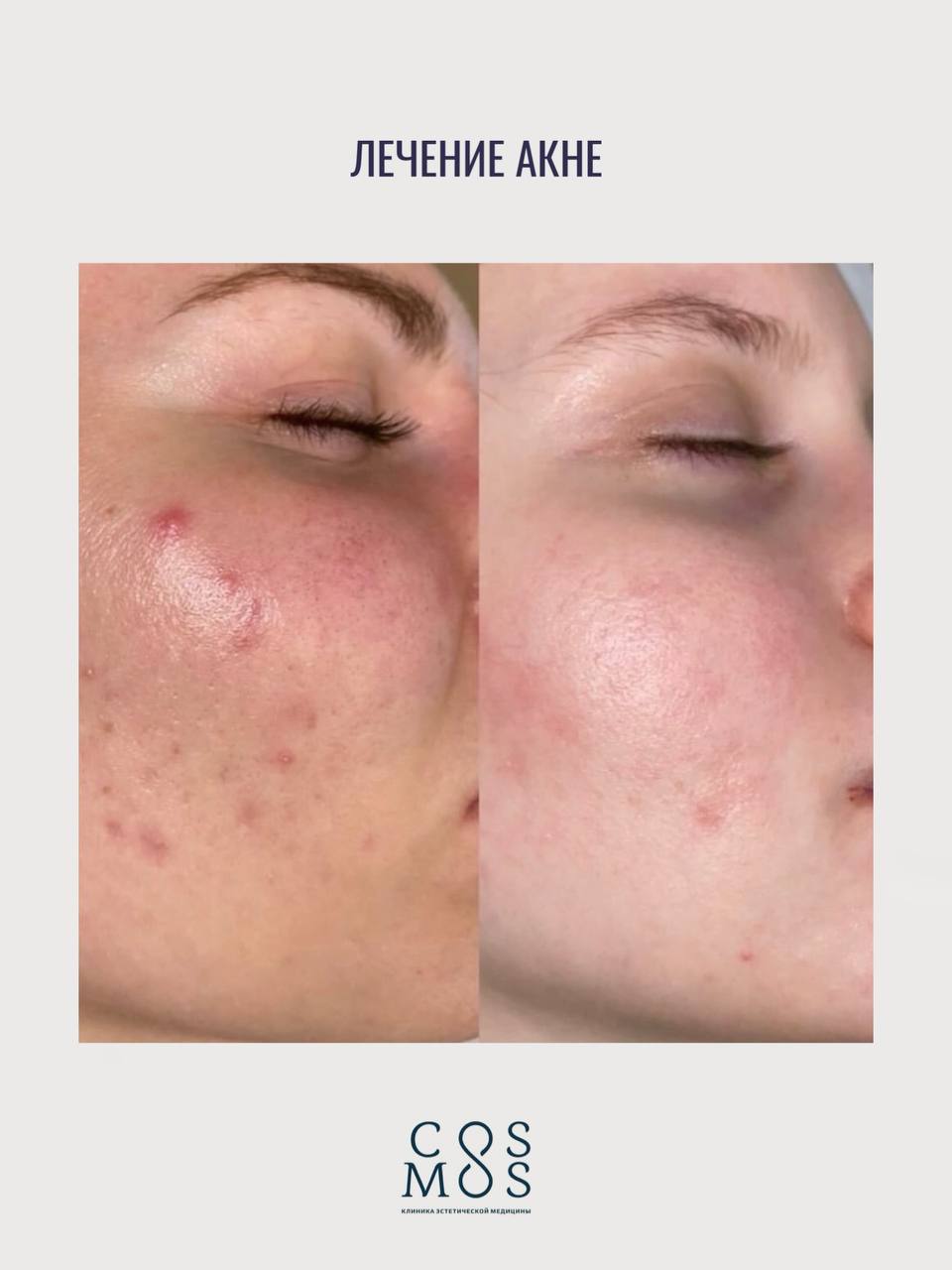 Косметология сертификаты