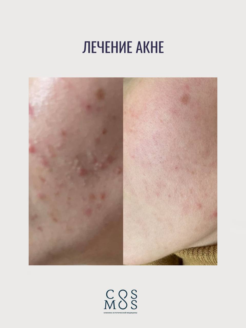 Косметология сертификаты