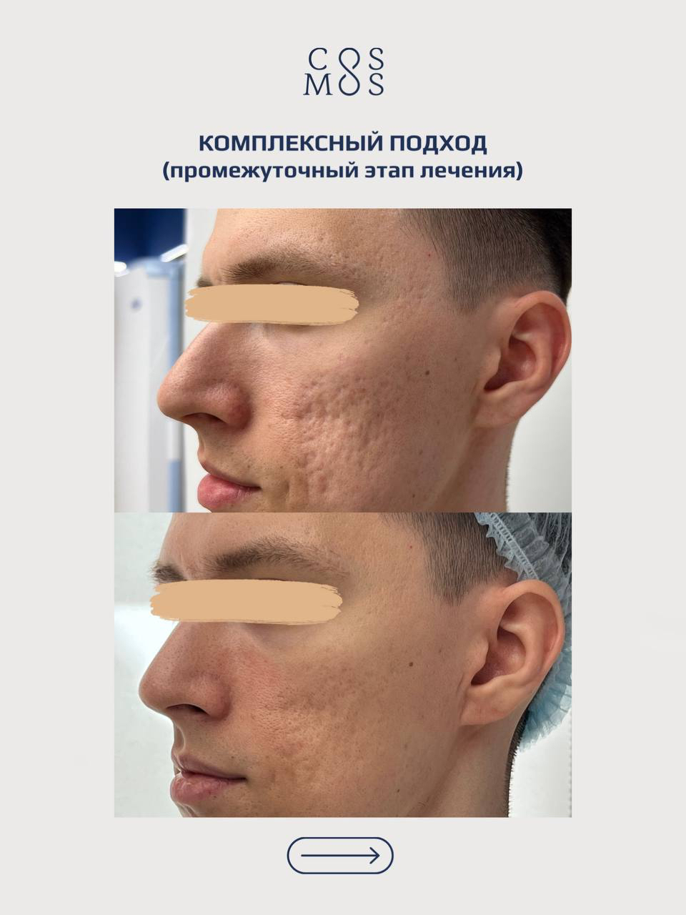 Комплексный подход