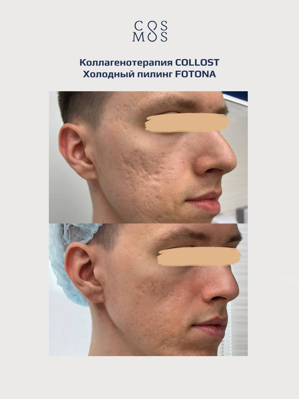 Комплексный подход