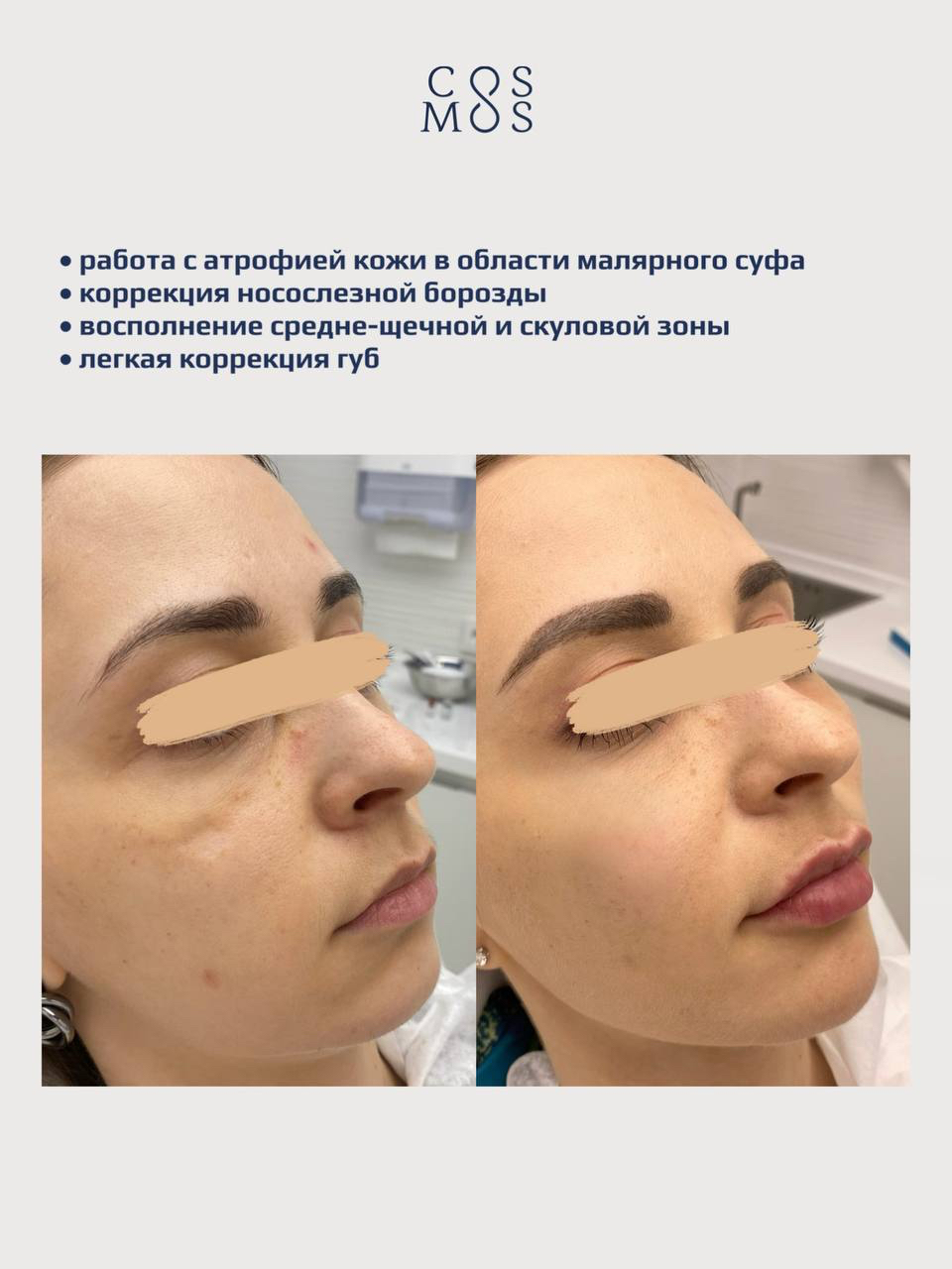 Комплексный подход в косметологии