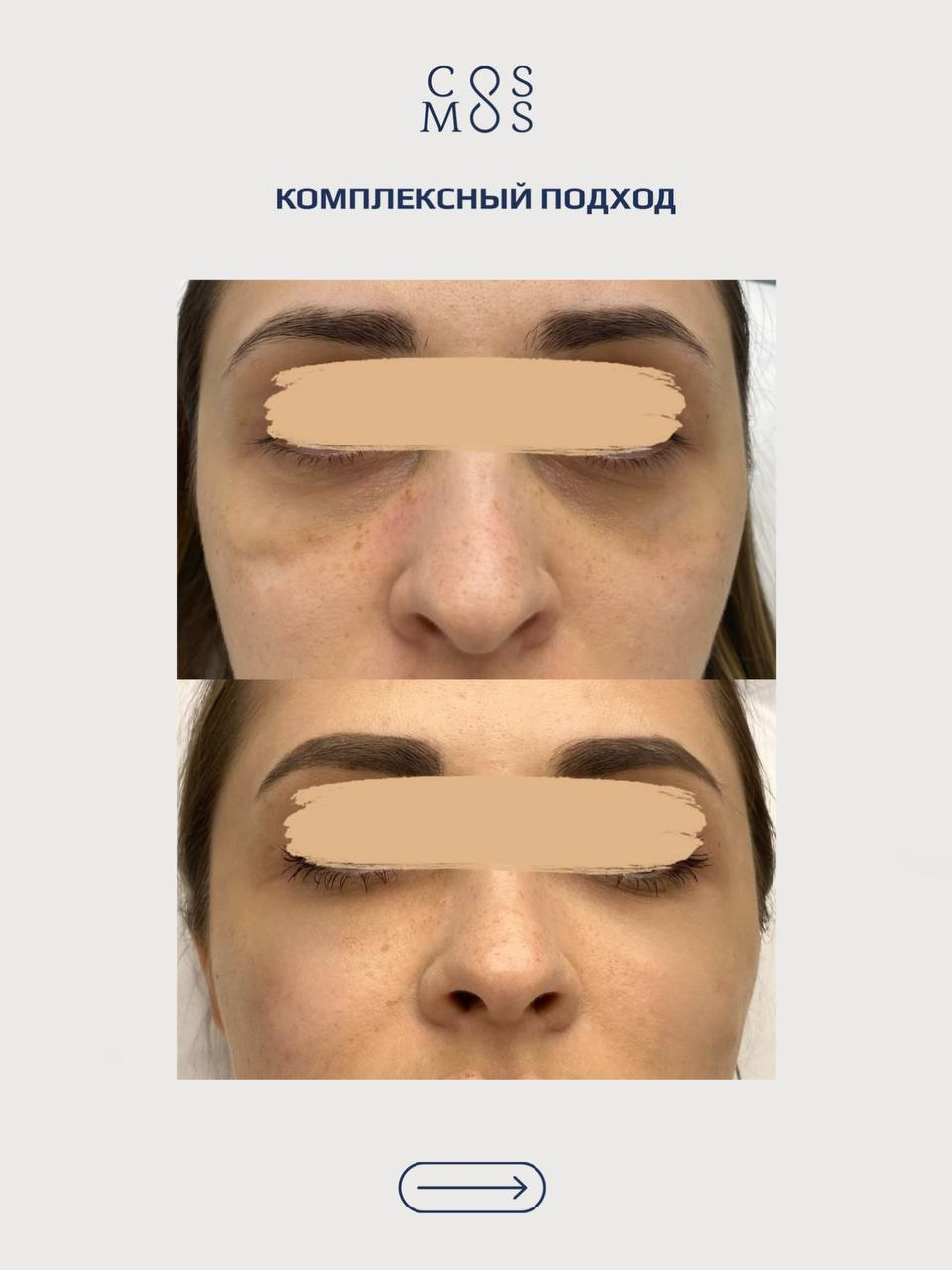 Комплексный подход в косметологии