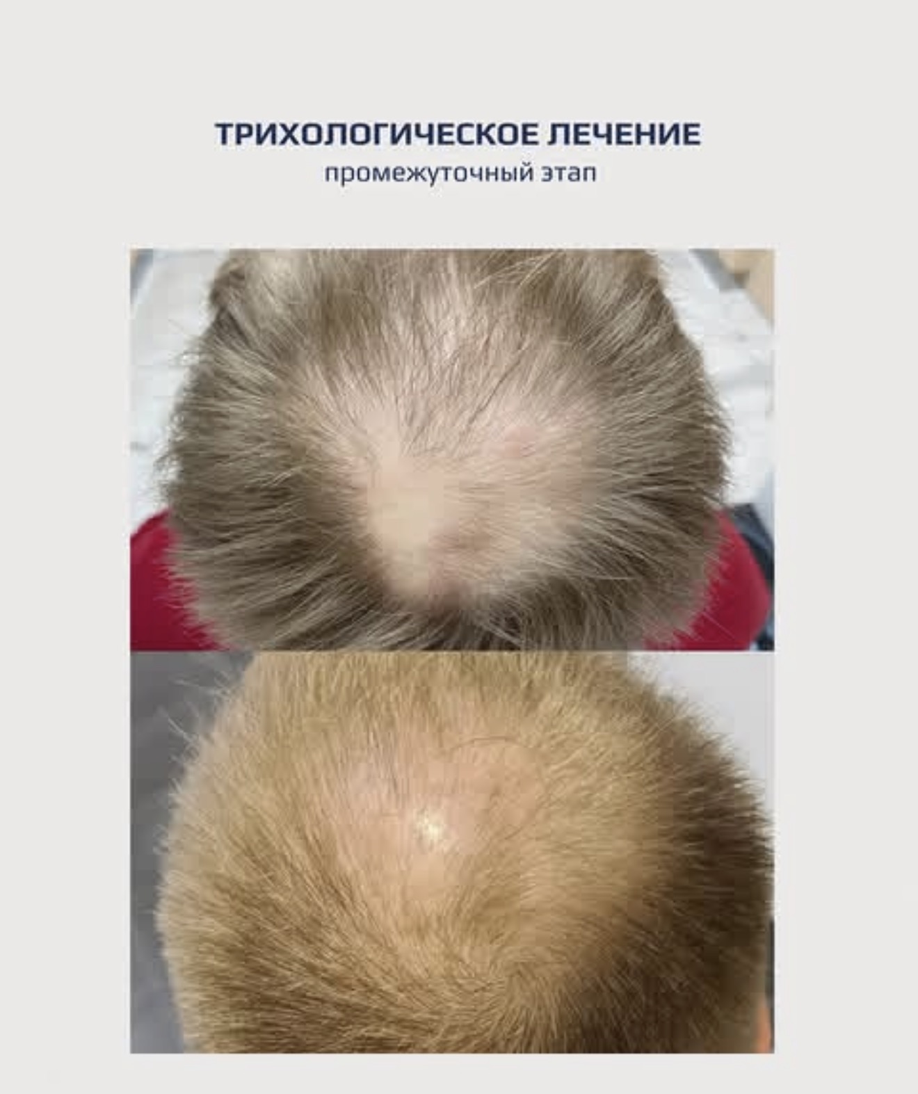 Мужская косметология