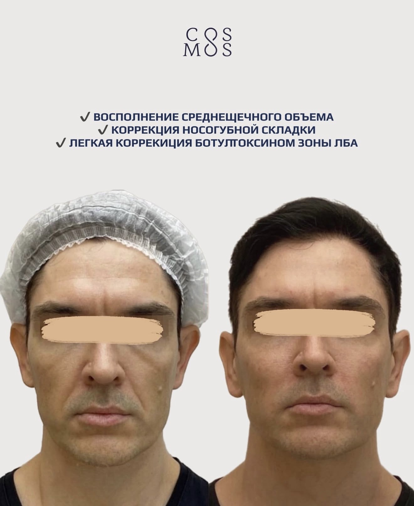 Мужская косметология